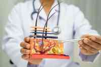 Haarwurzeltransplantation umsatzsteuerfrei